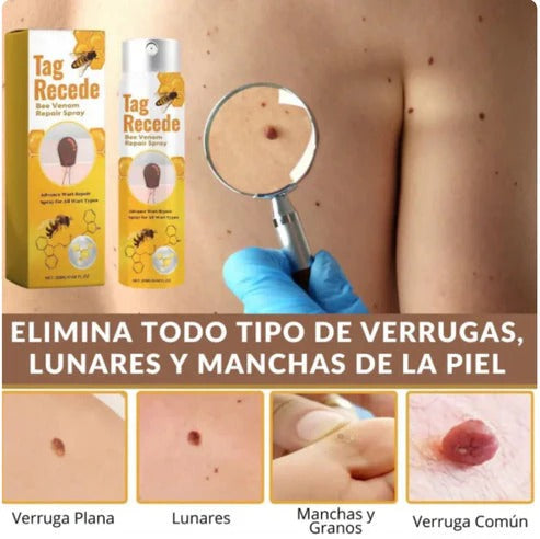 Tag Recede Eliminador de verrugas