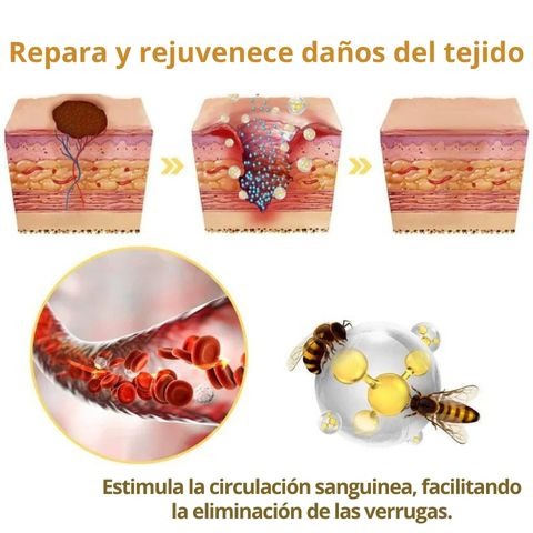 Tag Recede Eliminador de verrugas